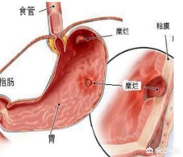 杀星类抗生素副作用#拜复乐属于哪一类抗生素